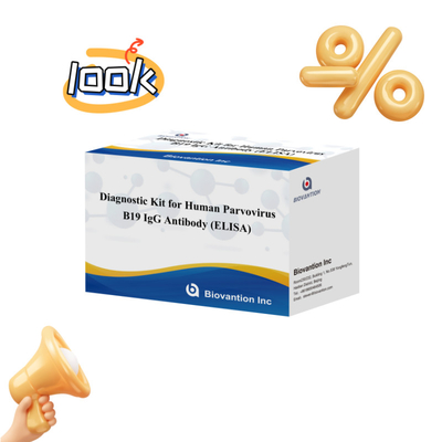 Kit de diagnóstico para o parvovírus humano B19 IgM ELISA de anticorpos Ideal para eritema infeccioso e complicações na gravidez