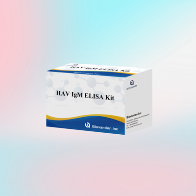 HAV IgM ELISA Kit Alta sensibilidade Hepatite A Detecção de vírus Teste de diagnóstico confiável e preciso para laboratórios clínicos