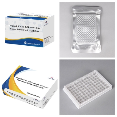Kit de teste ELISA avançado de anticorpos IgM do parvovírus humano B19 para detecção e rastreamento da gravidez