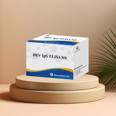Kit de teste ELISA HEV-IgG de alta sensibilidade com tamanho de 96T e validade de 18 meses para diagnóstico de hepatite E