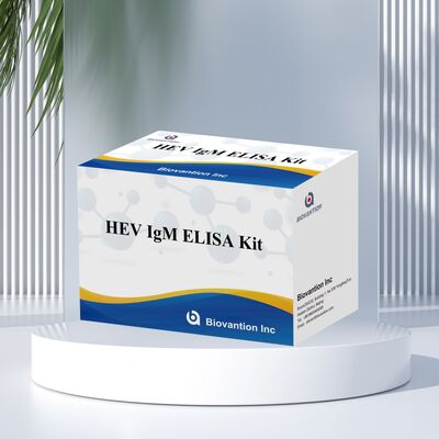 Kit de teste Elisa IgM HEV de alta sensibilidade com tamanho de 96T e tempo de ensaio de 2-3 horas para diagnóstico preciso