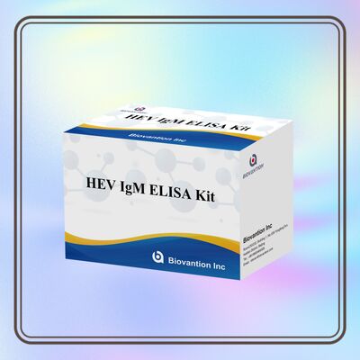 Kit de teste Elisa IgM HEV de alta sensibilidade com tamanho de 96T e tempo de ensaio de 2-3 horas para diagnóstico preciso