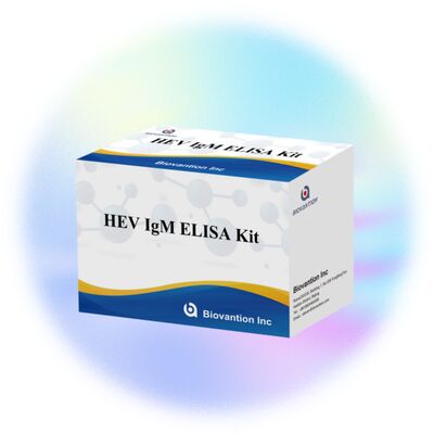 Kit de teste Elisa IgM HEV de alta sensibilidade com tamanho de 96T e tempo de ensaio de 2-3 horas para diagnóstico preciso
