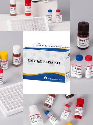 Kit de ensaio de alta precisão de IgG Elisa para CMV em laboratório ou hospital