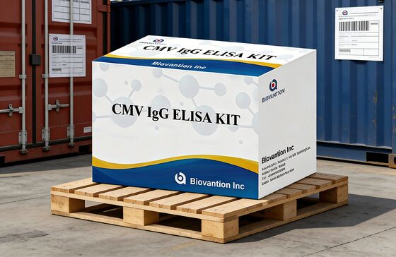 Kit de ensaio de alta precisão de IgG Elisa para CMV em laboratório ou hospital