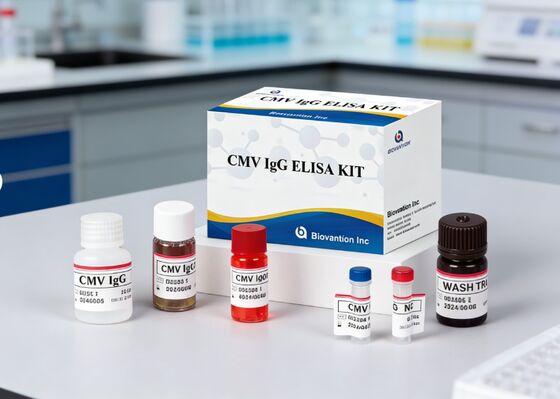 Kit de ensaio de alta precisão de IgG Elisa para CMV em laboratório ou hospital