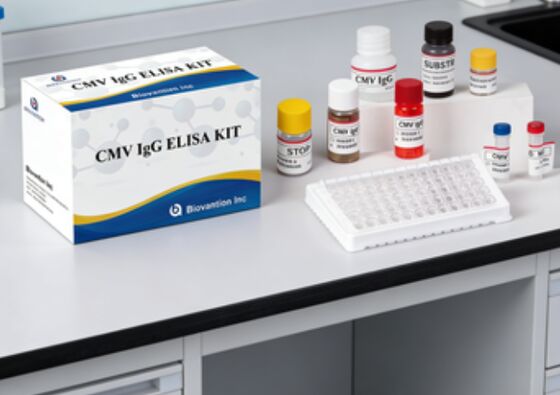 Kit de ensaio de alta precisão de IgG Elisa para CMV em laboratório ou hospital