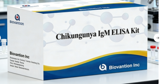 Chikungunya IgM ELISA Kit / High Sensitivity Chikungunya Virus IgM Antibody