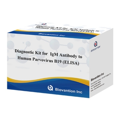 Kit de diagnóstico para o parvovírus humano B19 IgM ELISA de anticorpos Ideal para eritema infeccioso e complicações na gravidez